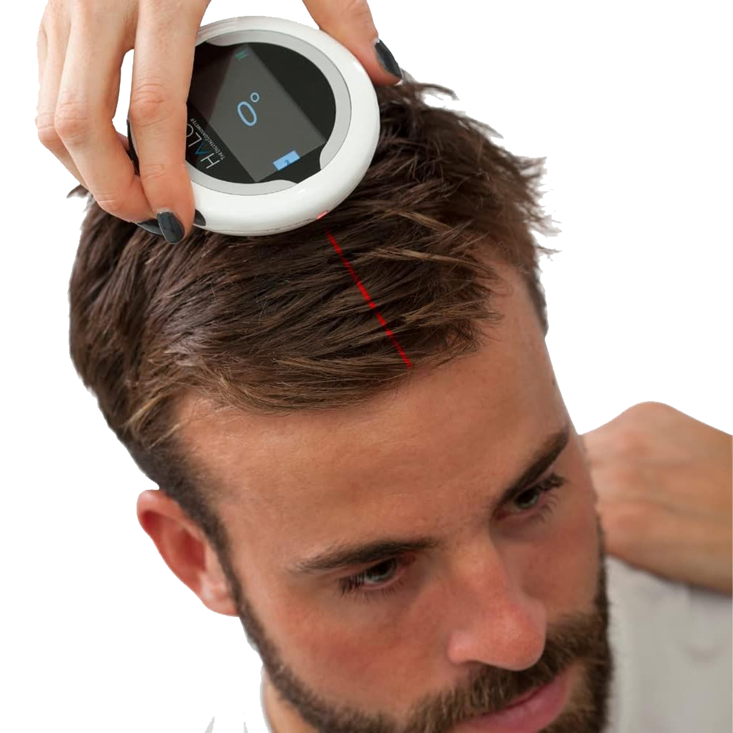 HALO Digital Goniometer